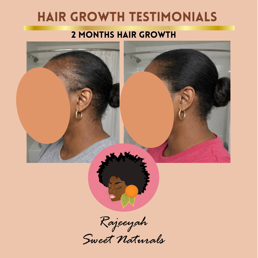 Batana Oil Hair Growth Treatment