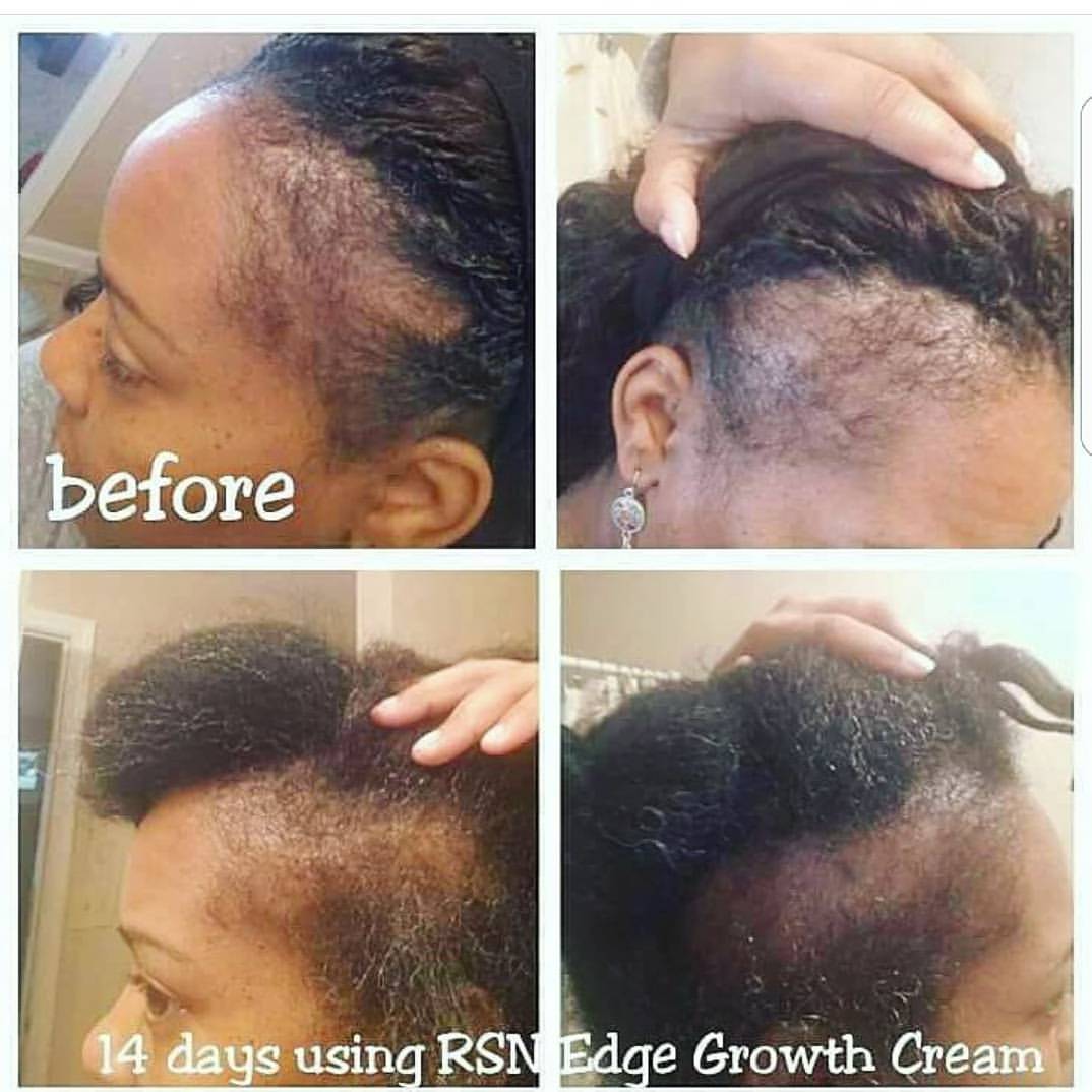 Edge Growth Cream